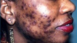 Picsart 23 04 20 09 57 51 787