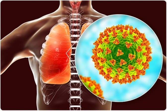 Cutar MERS 1 shutterstock 1686769399