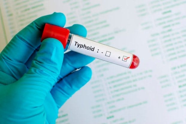 Taifot (typhoid) 2 typhoid0