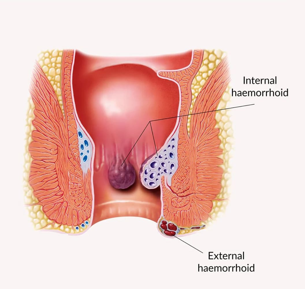 Basir na ciki da na waje.